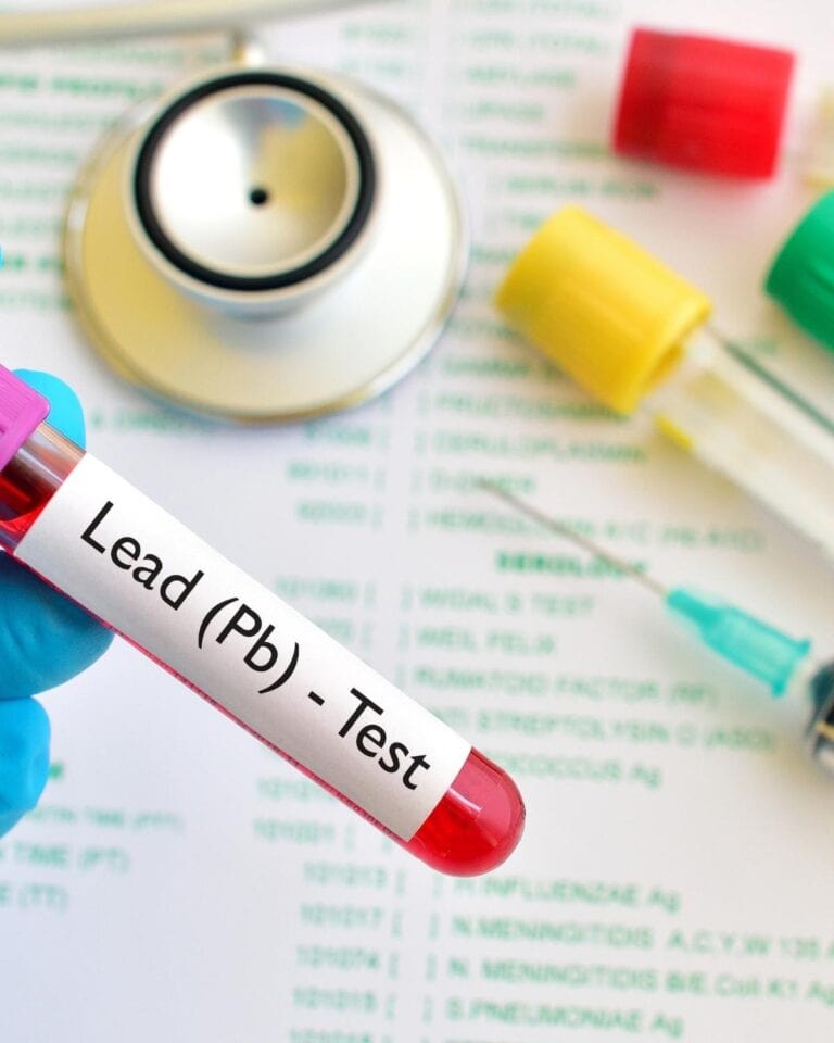 How To Test For Lead Exposure At Home | Full Guide To At-Home Testing